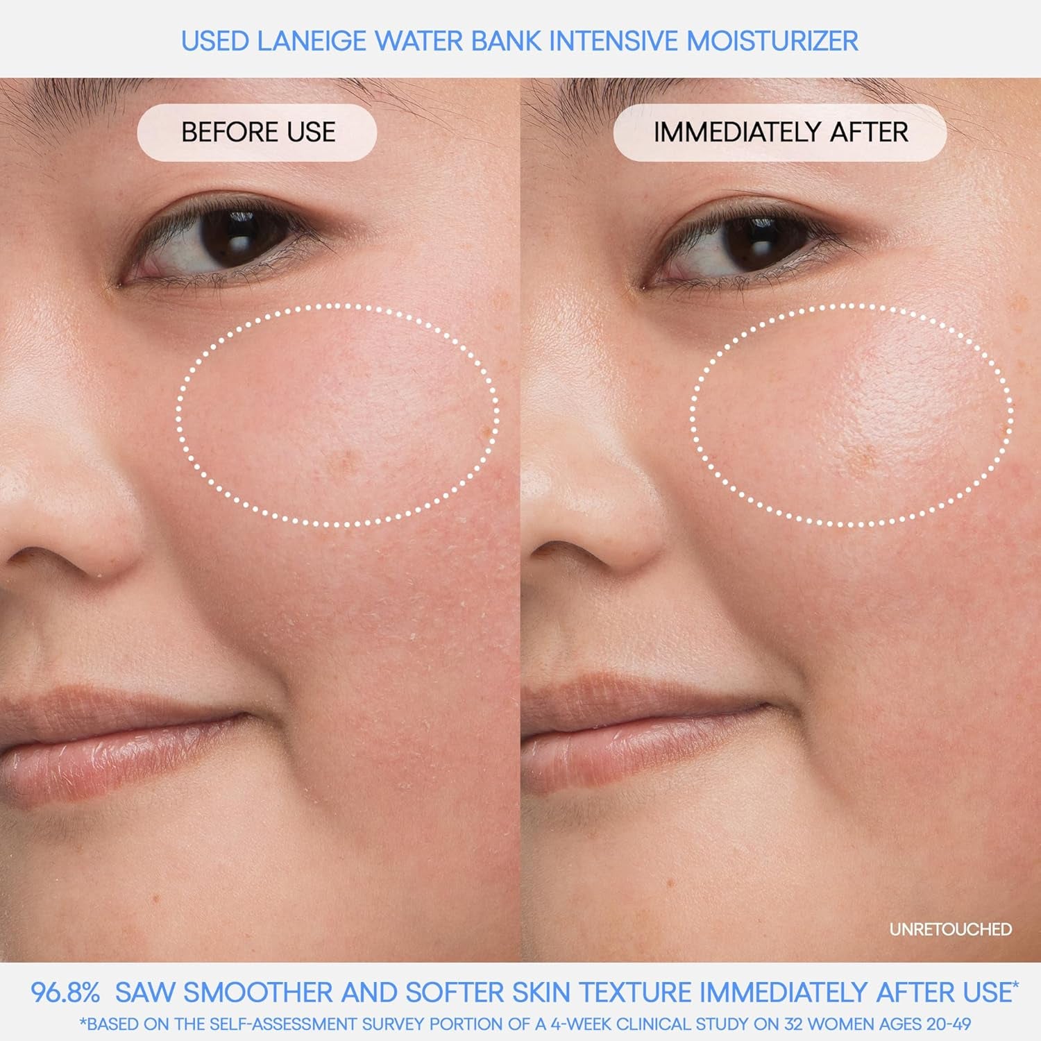 Water Bank Blue Hyaluronic Intensive Moisturizer: Hydrating Face Cream for Extra Dry Skin with Squalane & Peptide for Skin Barrier Support, Dermatologist-Tested